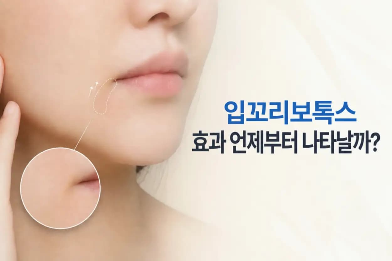 입꼬리 주변 피부와 근육 위치를 점선으로 표시한 입꼬리보톡스 효과 시기별 변화 썸네일