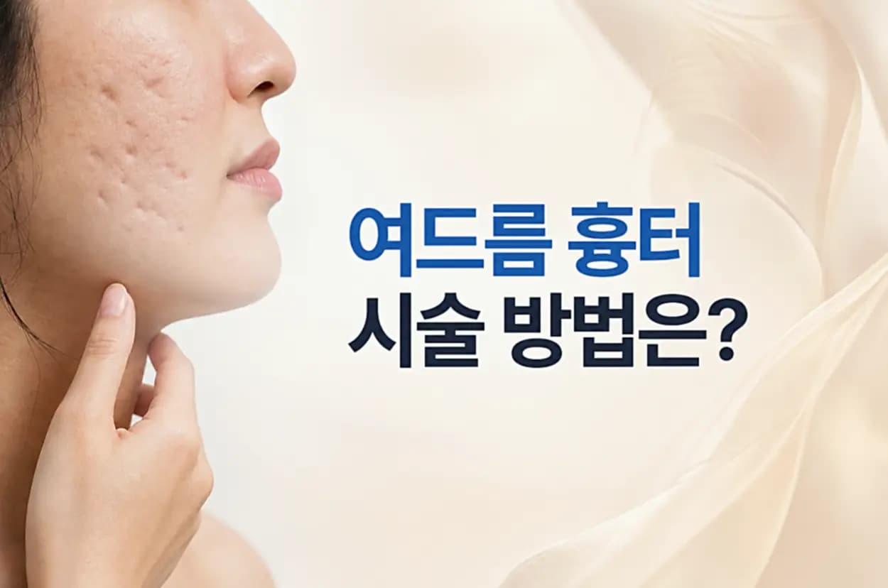 볼 피부의 패인 여드름 흉터와 진피 콜라겐 재형성 확대 컷을 담은 여드름 흉터 시술 횟수 썸네일